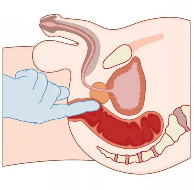 Položaj muške G-točke